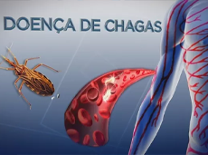 SBC lançará nova diretriz sobre a cardiomiopatia da doença de Chagas durante 77º CBC